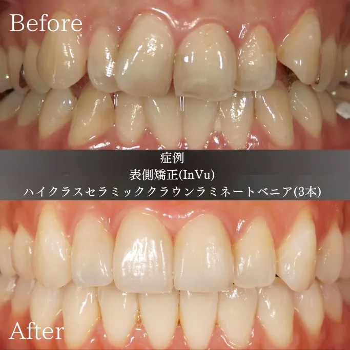 歯列矯正だけでは叶わない「美しさ」