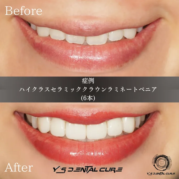 フェイススキャンで叶える笑顔