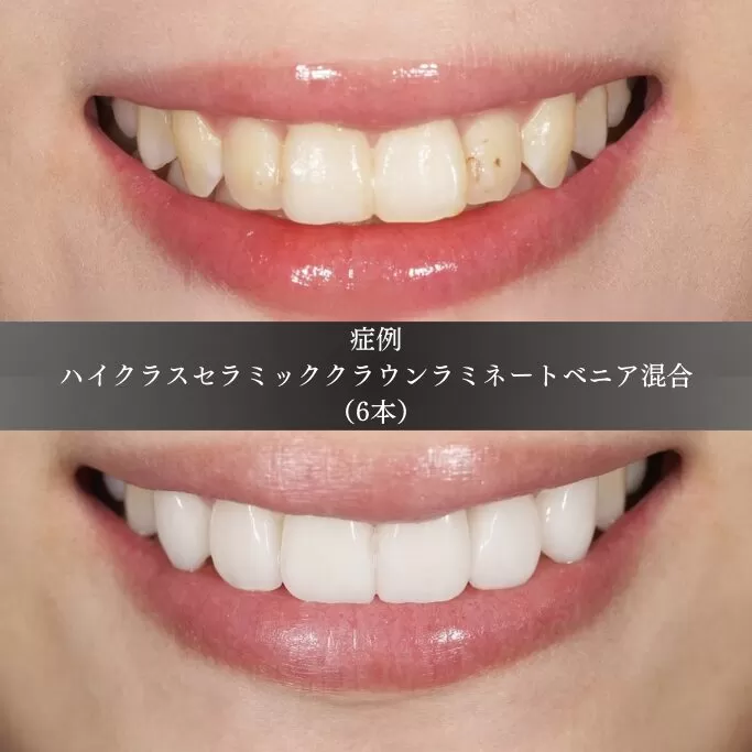 大きく、出っ張っている前歯を整えたい、引っ込めたい